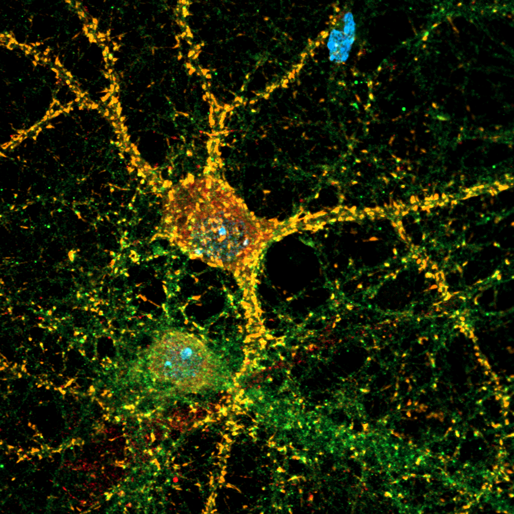 Нейроны, астроциты и ядра